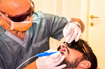 rimozione della carie Studio Dentistico Sacripante di Teramo e Cermignano